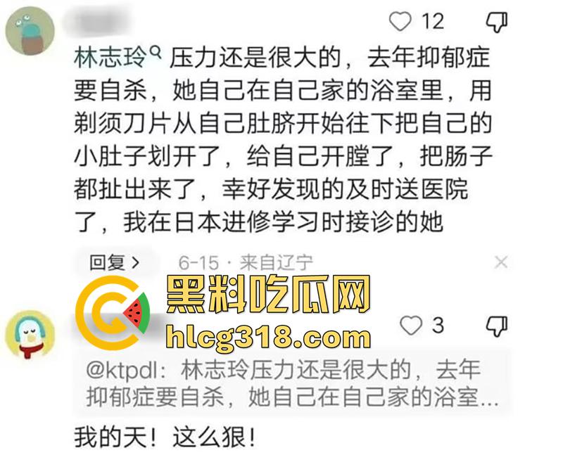 林志玲嫁入日本后真实近况,不仅被老公殴打家暴,还用她的身体交换资源,甚至多次玩换妻游戏!-1