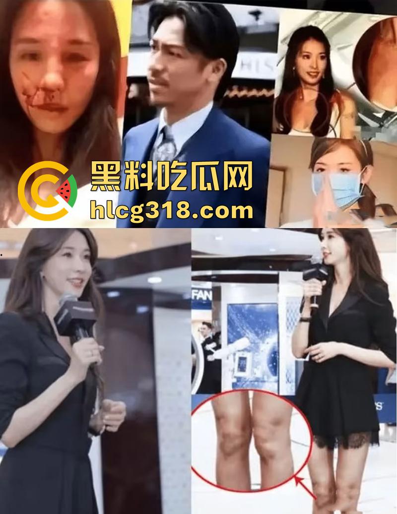 林志玲嫁入日本后真实近况,不仅被老公殴打家暴,还用她的身体交换资源,甚至多次玩换妻游戏!-2