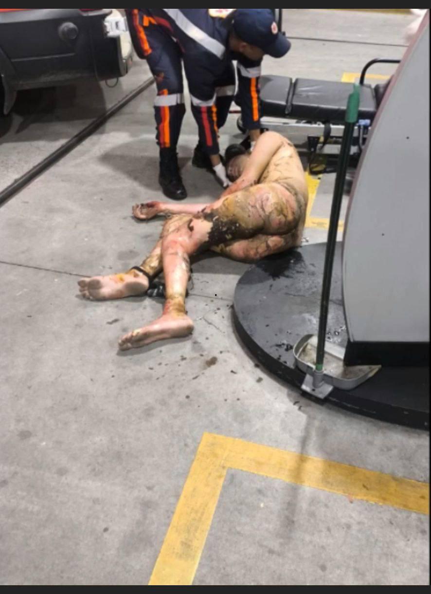 巴西心碎男分手后伤心欲绝，汽油自焚，监控曝光现场惨烈，大火吞噬全身，血肉模糊令人不忍直视-10