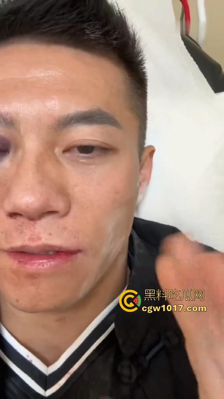 通背拳传人赵鸿刚参加UFC扇耳光大赛被对手KO!曾以为在耳光大赛上无敌的武功,没想到是这种下场,真是花拳秀腿!-10