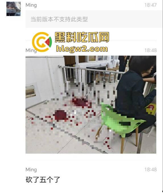 毕业证拿不到,实习费嫌少?21岁小伙持刀回母校发疯,无锡宜兴工艺学院8死17伤,一路无差别捅女生!-2