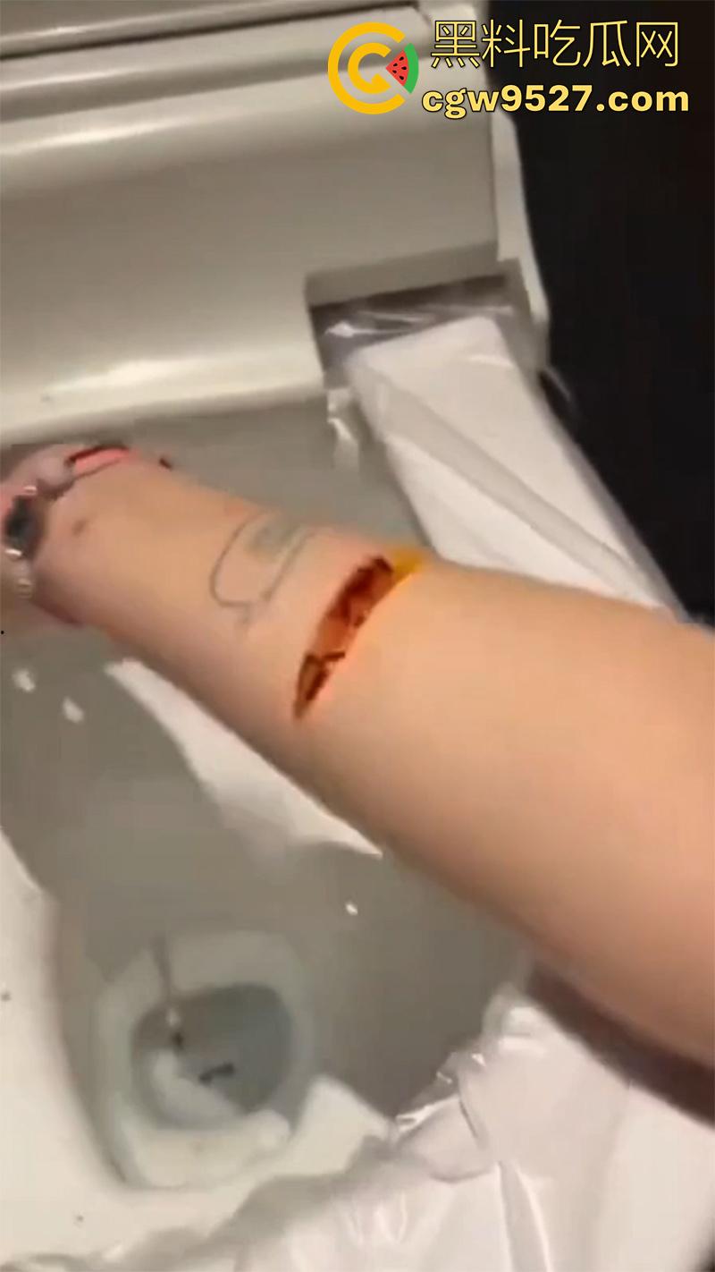 全网疯传马桶割腕女孩,真实自杀鸡皮疙瘩都起来了,脂肪层都割开了,还扒拉了一下,太重口了!-4