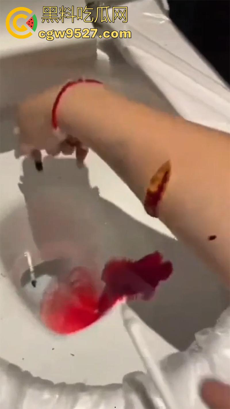 全网疯传马桶割腕女孩,真实自杀鸡皮疙瘩都起来了,脂肪层都割开了,还扒拉了一下,太重口了!-5