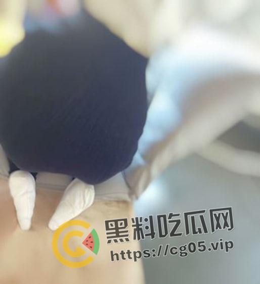 新时代裹脚女性！00后女生爱上裹脚 推特分享裹脚经历 把脚缠到骨折变形 吓人！-14