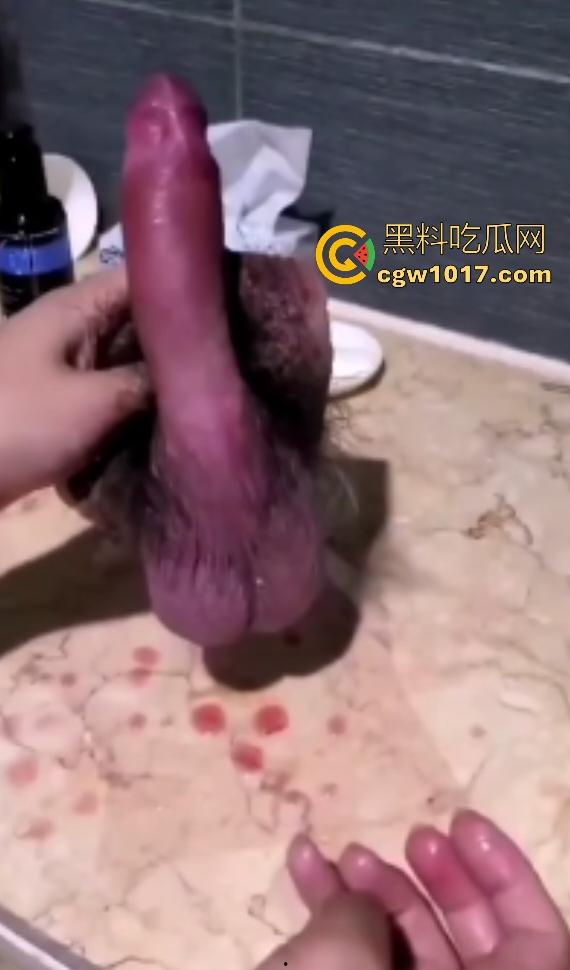 泰国自宫狂人嫌医院贵在家自割巨屌，落地后鸡巴还梆硬，后悔失去这武器，老爸见状怒吼“滚出家门”！-5