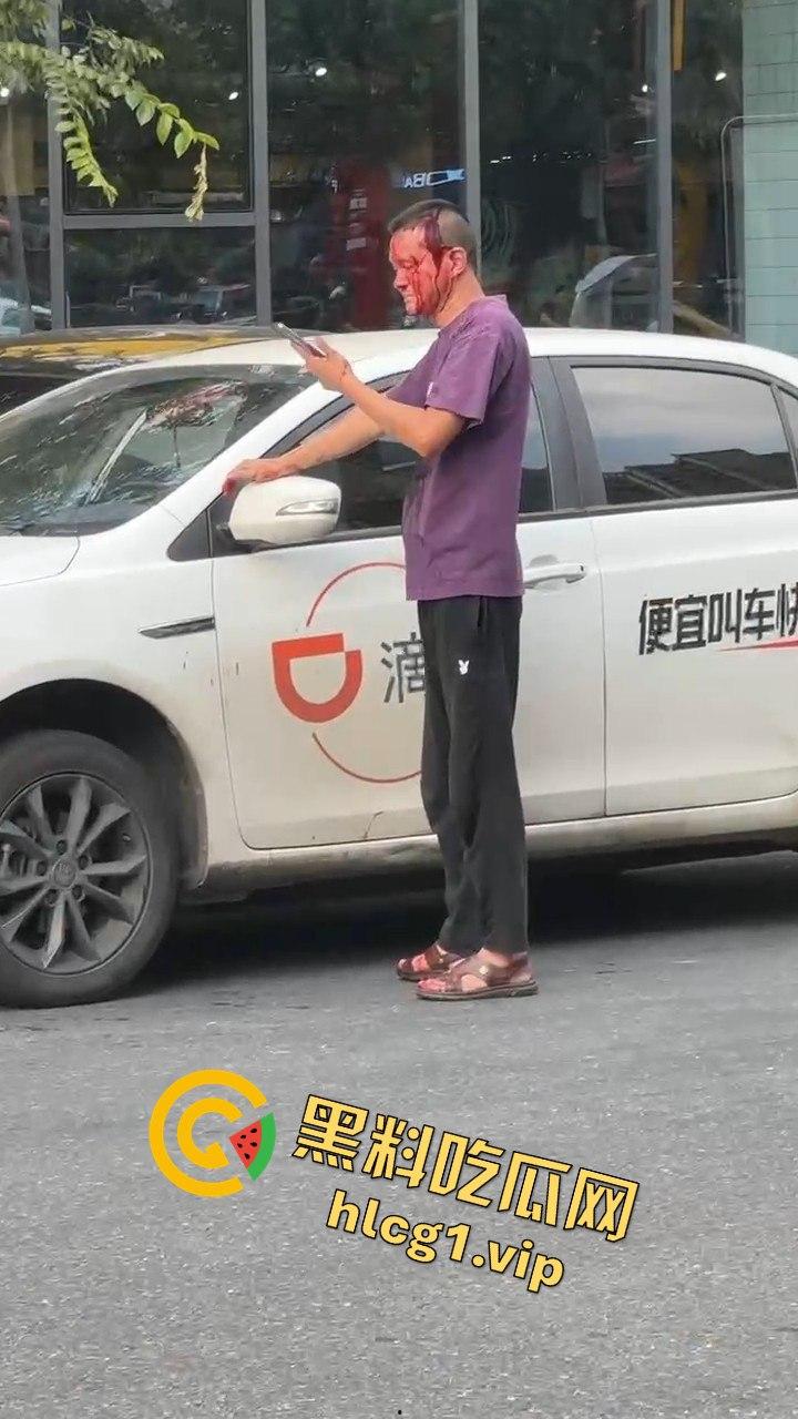 女子因价格争执叫来老公，掏出扳手开瓢，赔偿金额够买辆新车！-1