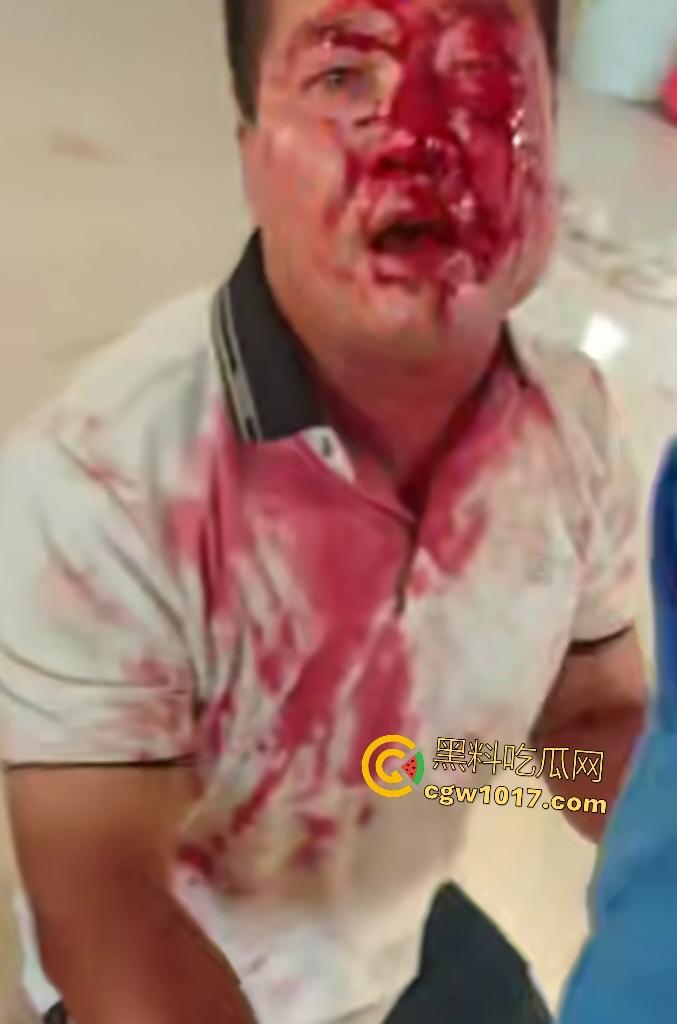 游戏团战关键时刻被老爸关电脑，网瘾儿子阿强直接打亲爸头破血流，老爸跪地求饶“我错了”，老妈哭求和解！-7