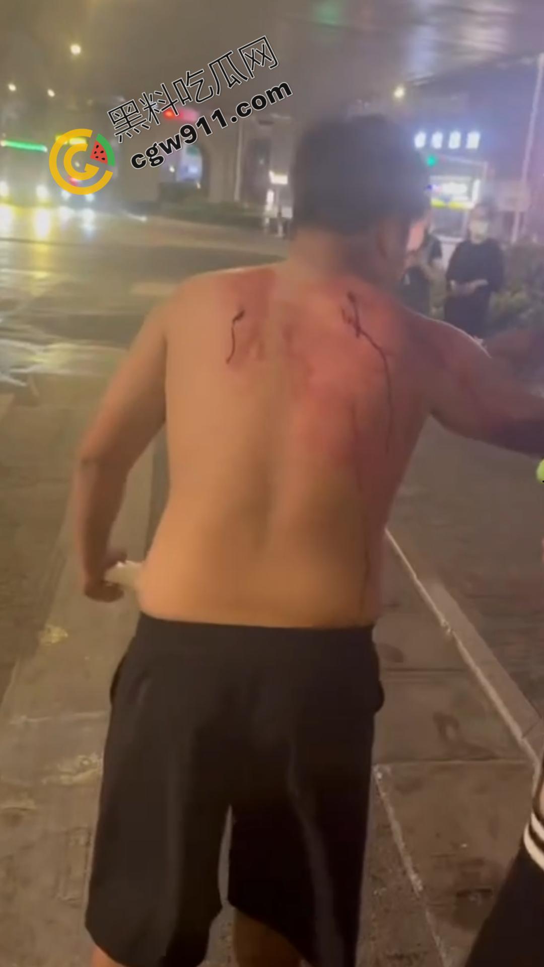 闹市惊现“刀妹狂魔”：穿着黑丝狂捅一男子，刀光四射，溅血街头，网络梗喧腾，路人惊逃-10