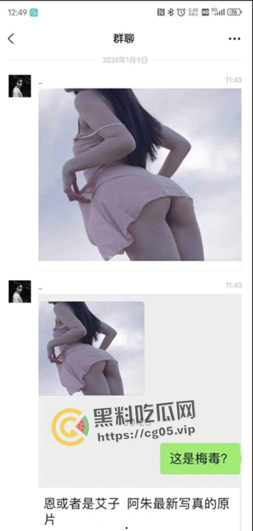 鸡圈顶流【阿朱】疑似患有梅毒？被细心网友拿着放大镜看深究美图，难道是上个月参加淫趴所得？-1