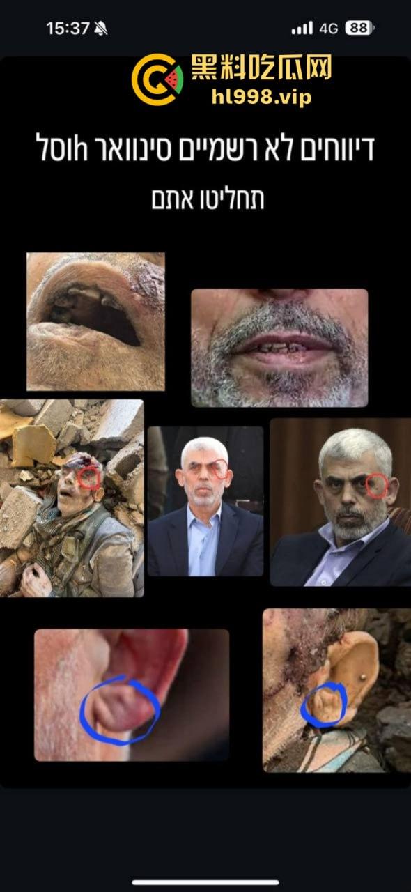 慎入!!!哈马斯领导人辛瓦尔被以方爆头击毙 遗体照片流露不忍直视!-9