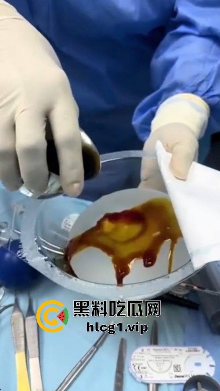 7W就能让你机场变巨乳！抖音上那些36D大胸妹子，原来都是这么来的！-8