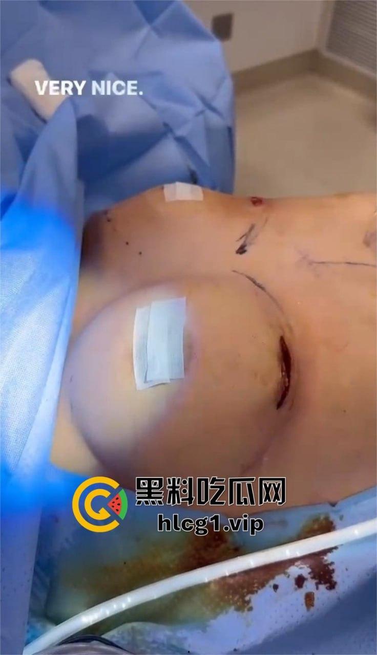 7W就能让你机场变巨乳！抖音上那些36D大胸妹子，原来都是这么来的！-16