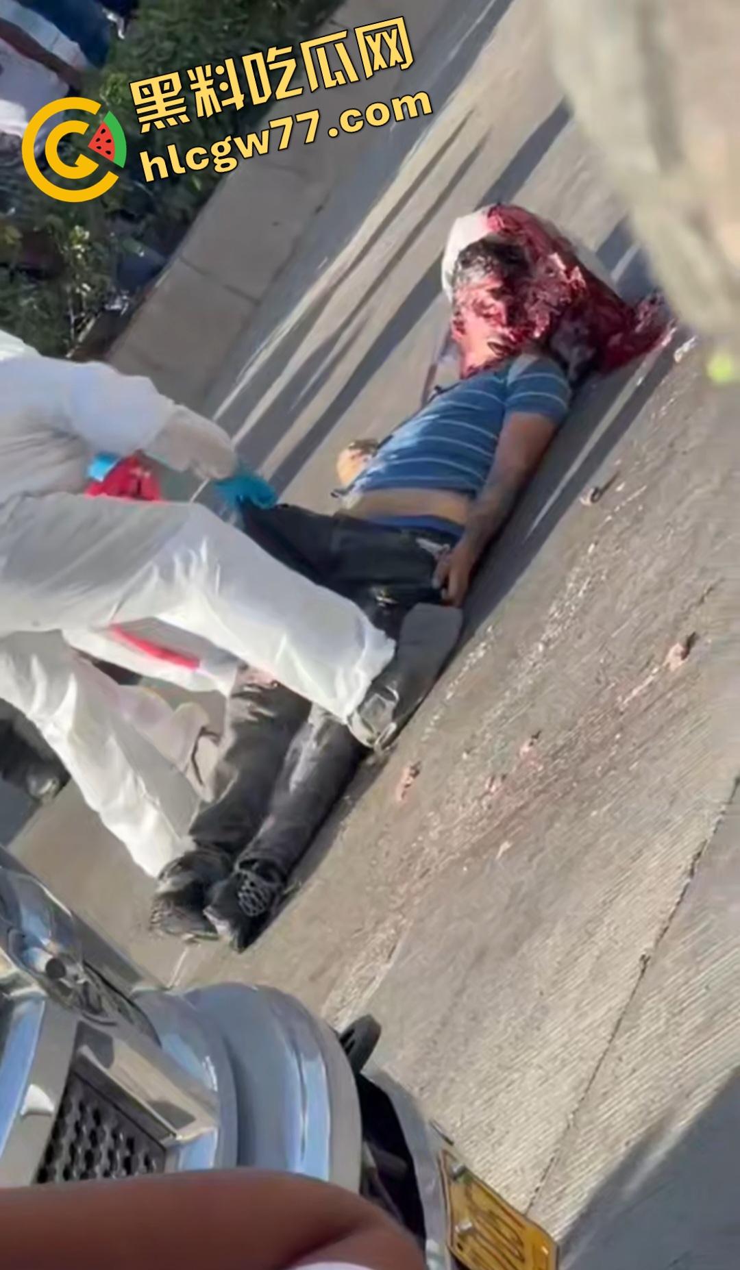 蓝色衣服男电动车车祸爆头血腥惨剧!眼珠弹出还能救?世上竟有神人?-2