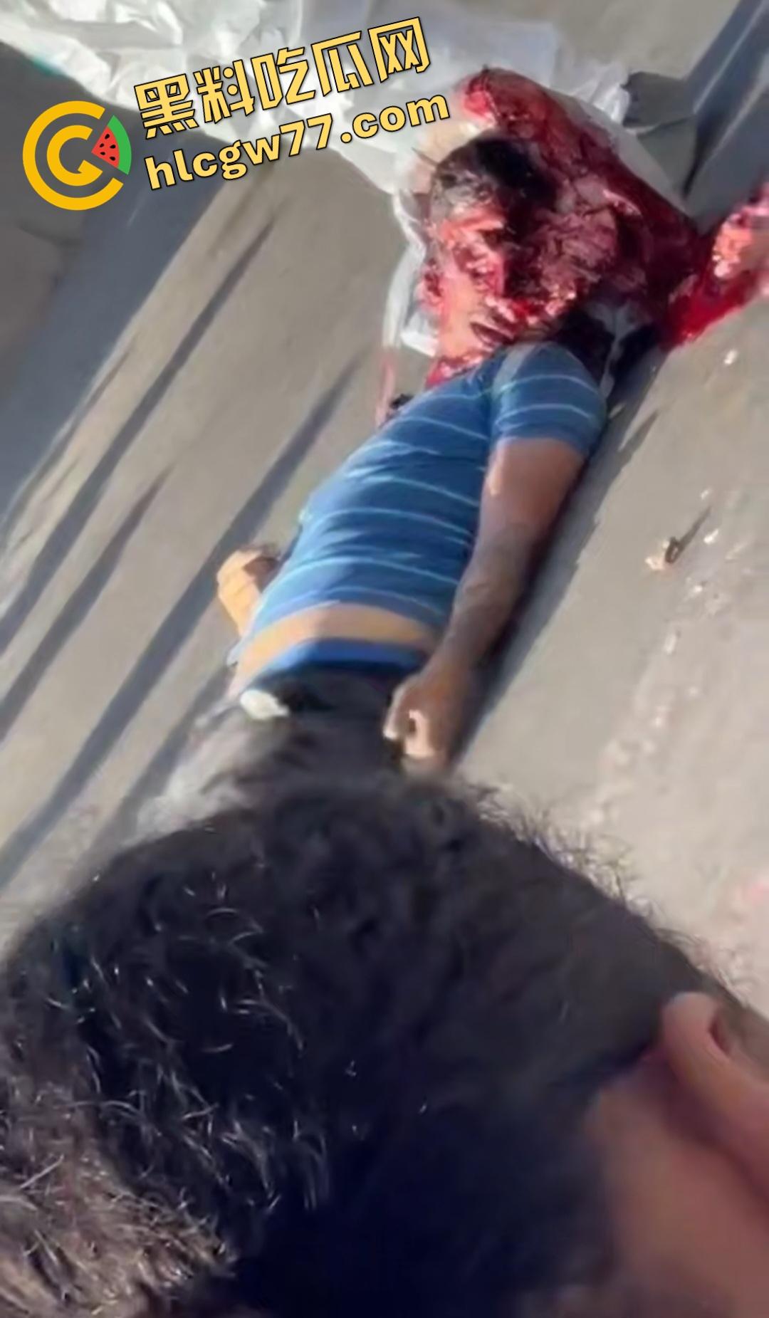 蓝色衣服男电动车车祸爆头血腥惨剧!眼珠弹出还能救?世上竟有神人?-3