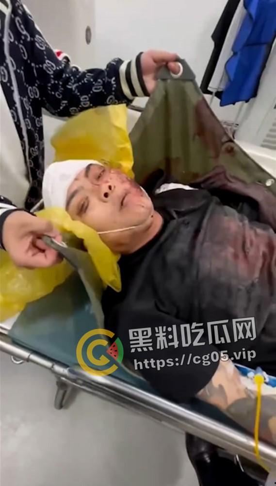 精神小伙哈尔滨斯卡拉迪厅前挑衅!上一秒嚣张至极 下一秒被打成猪头 活该-5