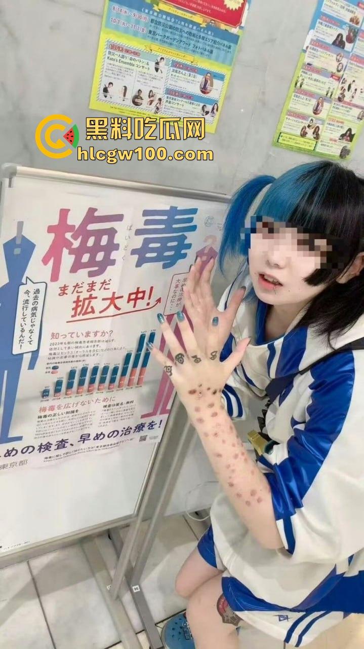 日本性病感染激增背后的文化畸形 性产业的泛滥让健康危机全面爆发 性病被当成时尚让性病成社会毒瘤！-8