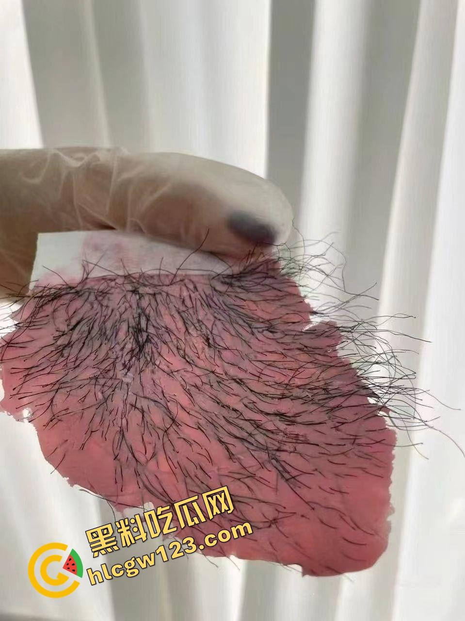 白虎不是天生的，是拔出来的，人工白虎养骗局曝光逼毛一根根扯，看得人蛋蛋一紧！-11