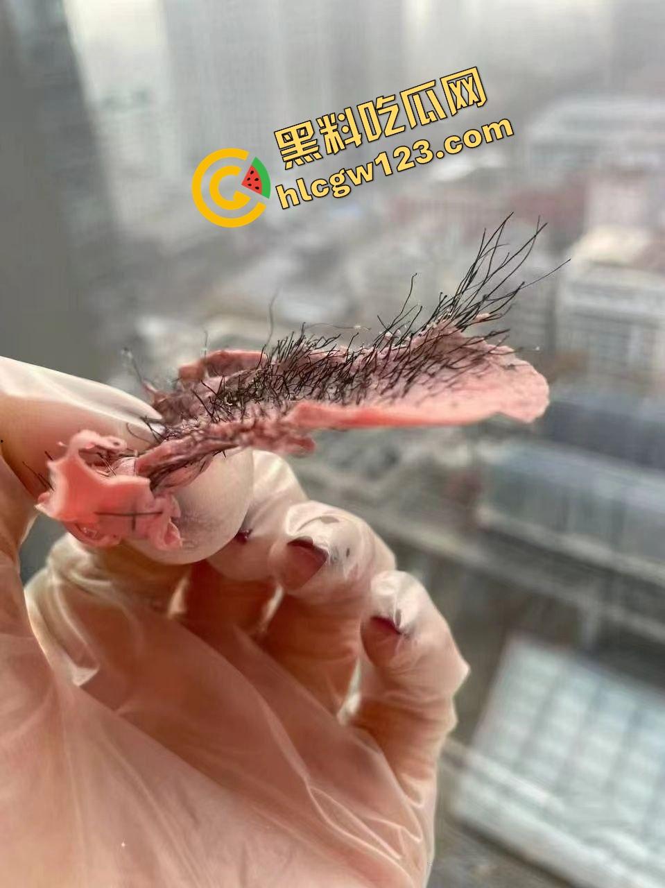 白虎不是天生的，是拔出来的，人工白虎养骗局曝光逼毛一根根扯，看得人蛋蛋一紧！-12