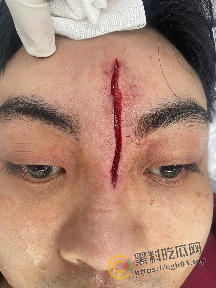 一场野球挣了66w！广州汇悦台野球场暴躁男【王帅】打球带肘给人开瓢   赔66w才能免坐牢-3