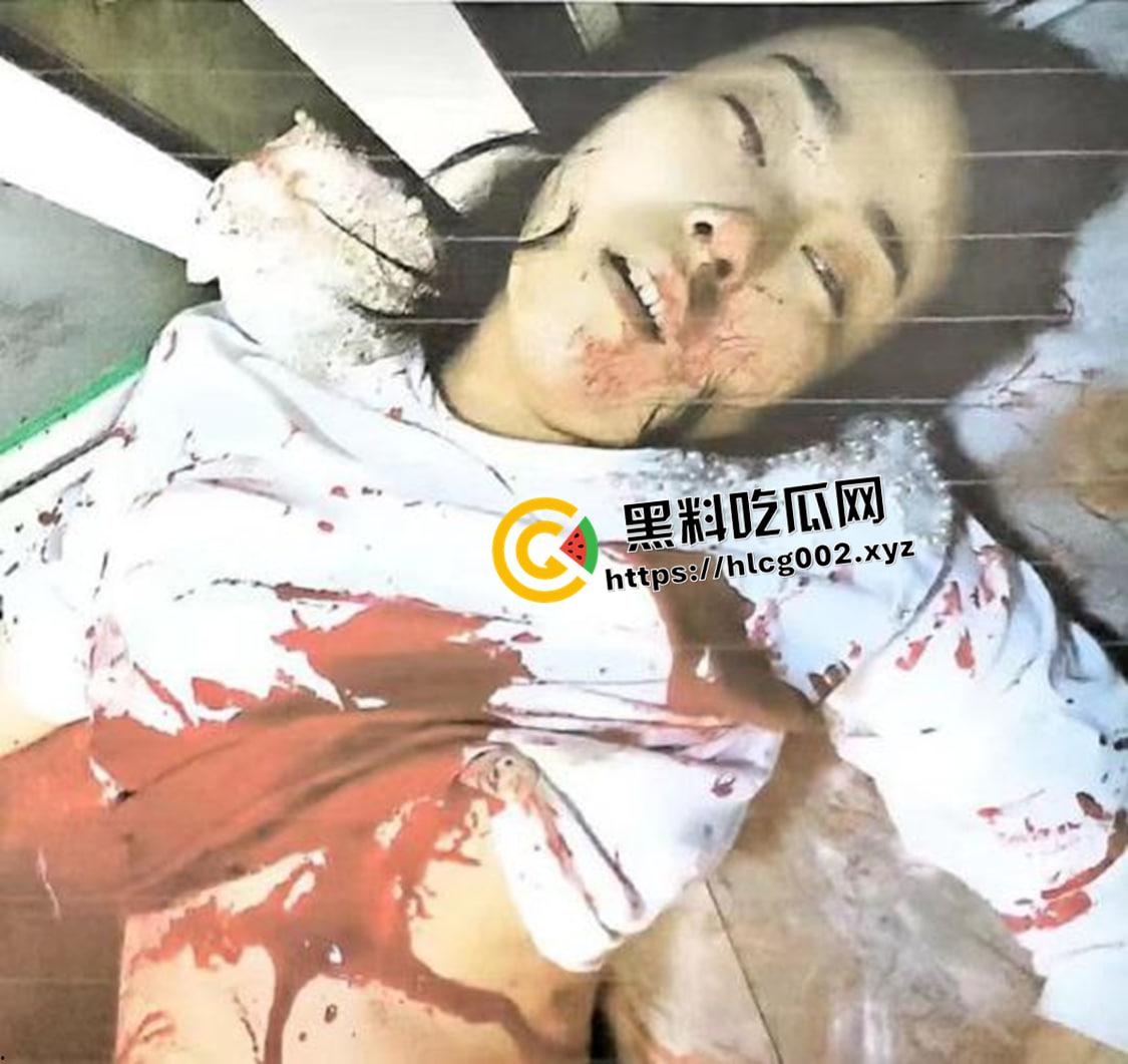 恐怖慎入!辽宁【徐园】案尸检现场视频流出 被前男友家暴致死打的面目全非-10