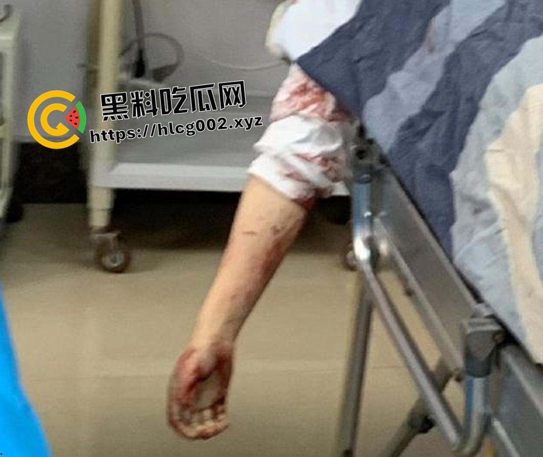 恐怖慎入!辽宁【徐园】案尸检现场视频流出 被前男友家暴致死打的面目全非-12