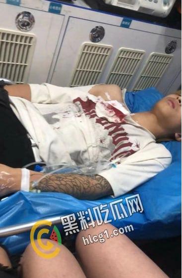 抖音热瓜 江西砍人现场!据说偷人十三四岁女刀手一人追砍两男一死一伤 后又被复仇砍伤 双双入院 太刺激了-7
