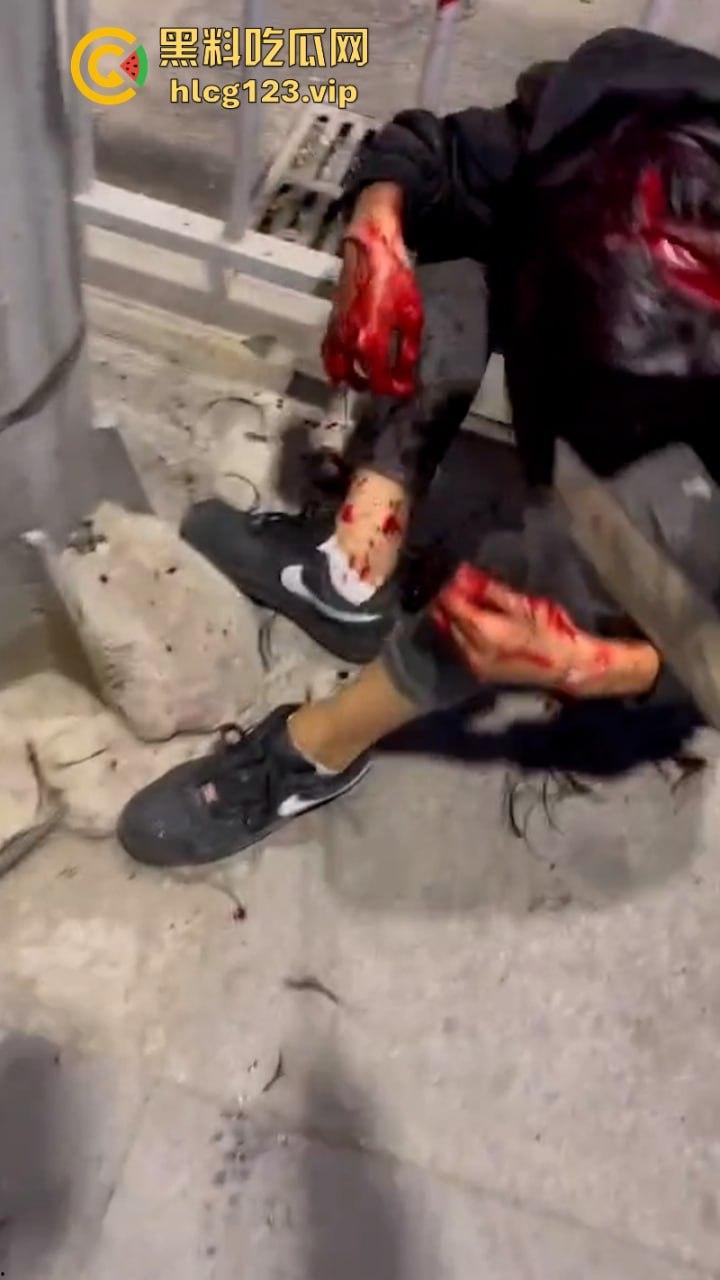 广东街头多人持刀互砍!血洒街头惨不忍睹 现场视频曝光砍头细节 太吓人了-10