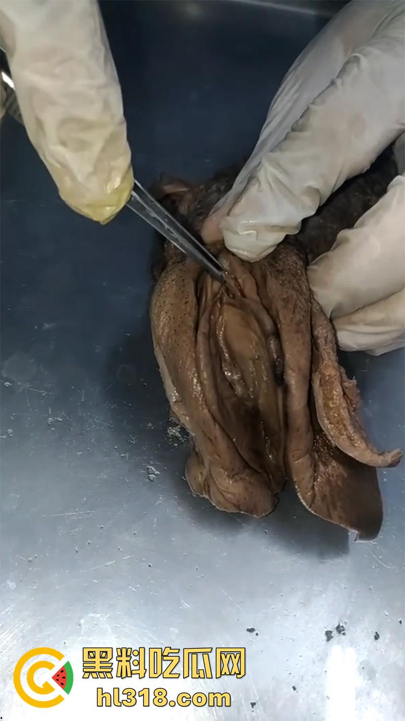 真实西藏密宗法器“肉莲花”，少女被108罗汉轮奸后，五毒侵蚀九蒸九炼，活体切割才可肉莲大成！-6