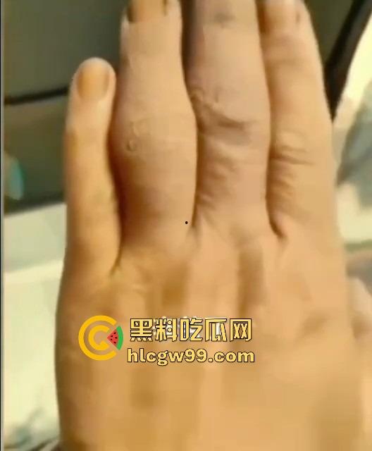 广州护士实习生『蓝美淇』开学前急约一炮，轻微洁癖却爱被抠逼，抠到手水肿，这逼是真湿还是有毒？-11