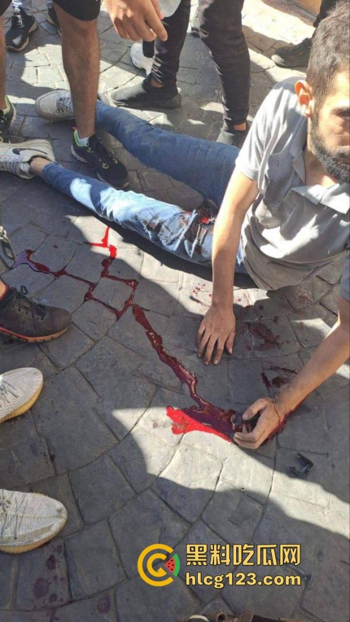 黎巴嫩发生大规模BP机爆炸事件 4000多人受伤 11人死亡 以色列远程植爆-2