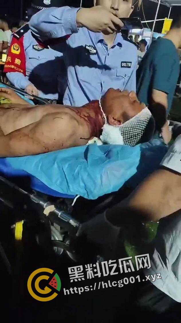 海南海口大致坡大陆人大战海南人 摸了本地人老婆地屁股 命就得留下 现场视频流出 真下死手-7