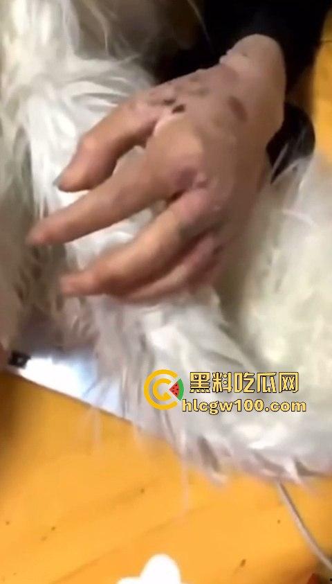 河南信阳啤酒森林酒吧惊现病毒母体！毒王身体浑身溃烂吓退众人，最近国内真的特别多各位瓜友一定要注意。-18