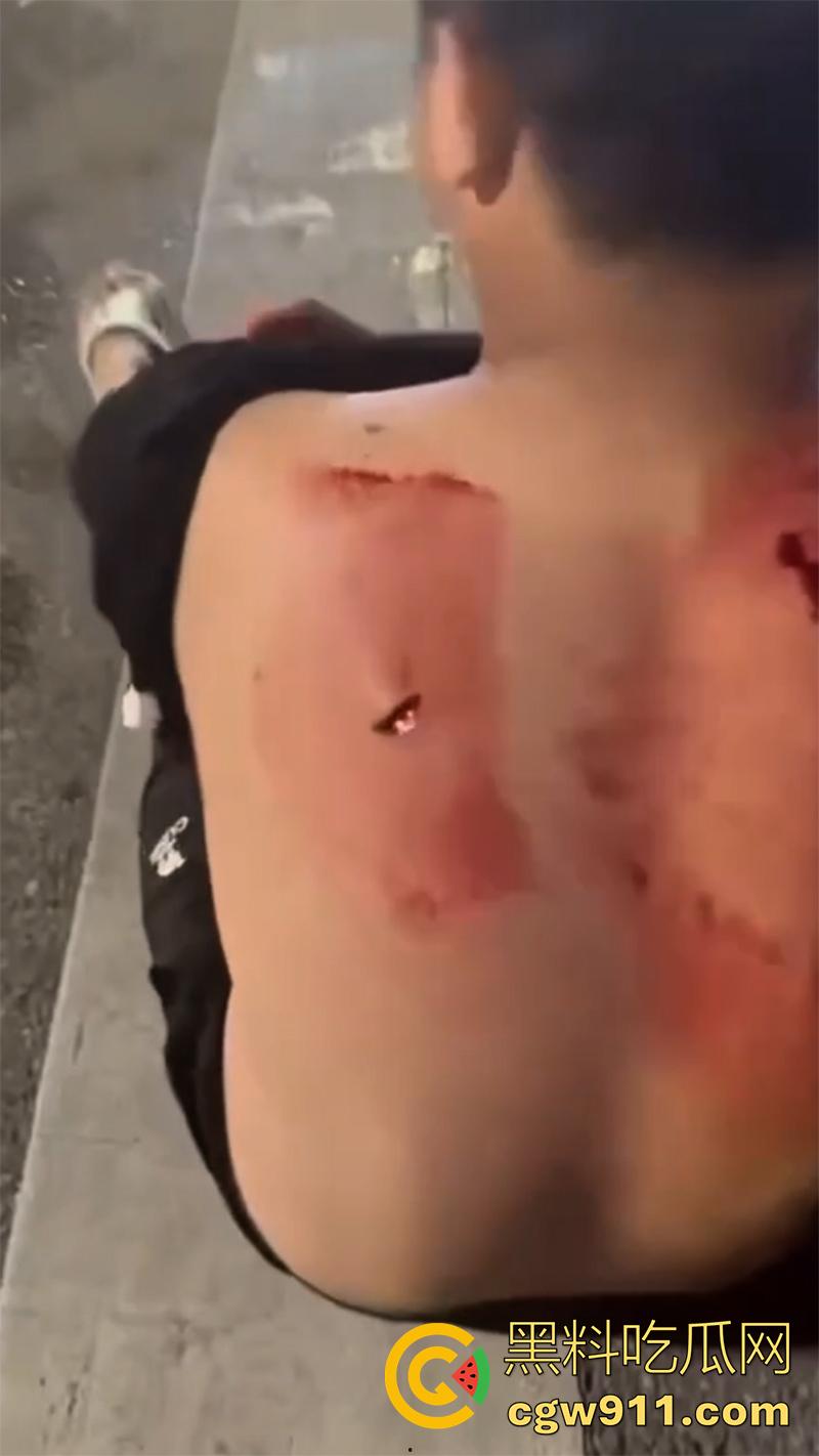 江西赣州第七中学，精神小伙小妹发生口角，叫人斗殴持砍刀砍人，警方和120急救人员陆续赶到，现场多人受伤。-4