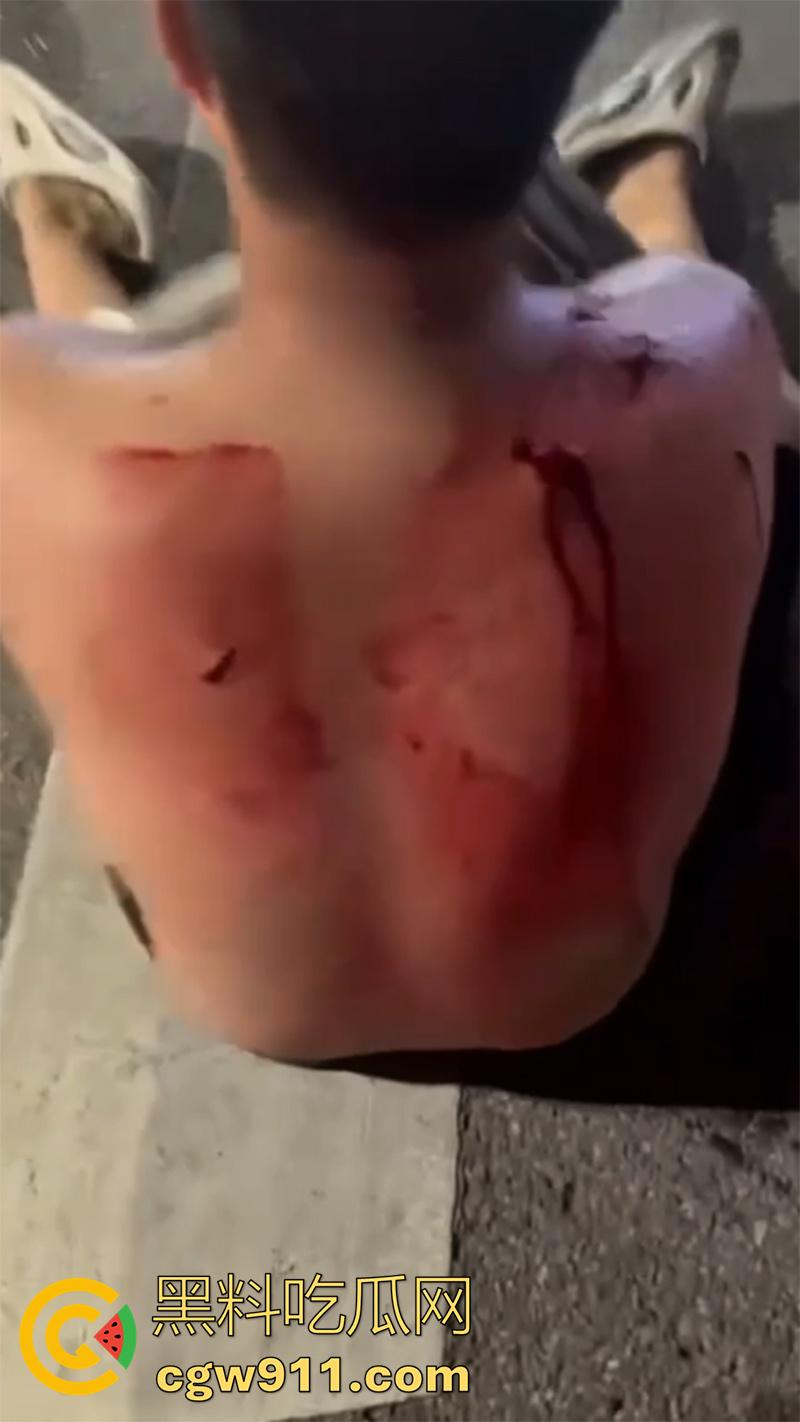 江西赣州第七中学，精神小伙小妹发生口角，叫人斗殴持砍刀砍人，警方和120急救人员陆续赶到，现场多人受伤。-5