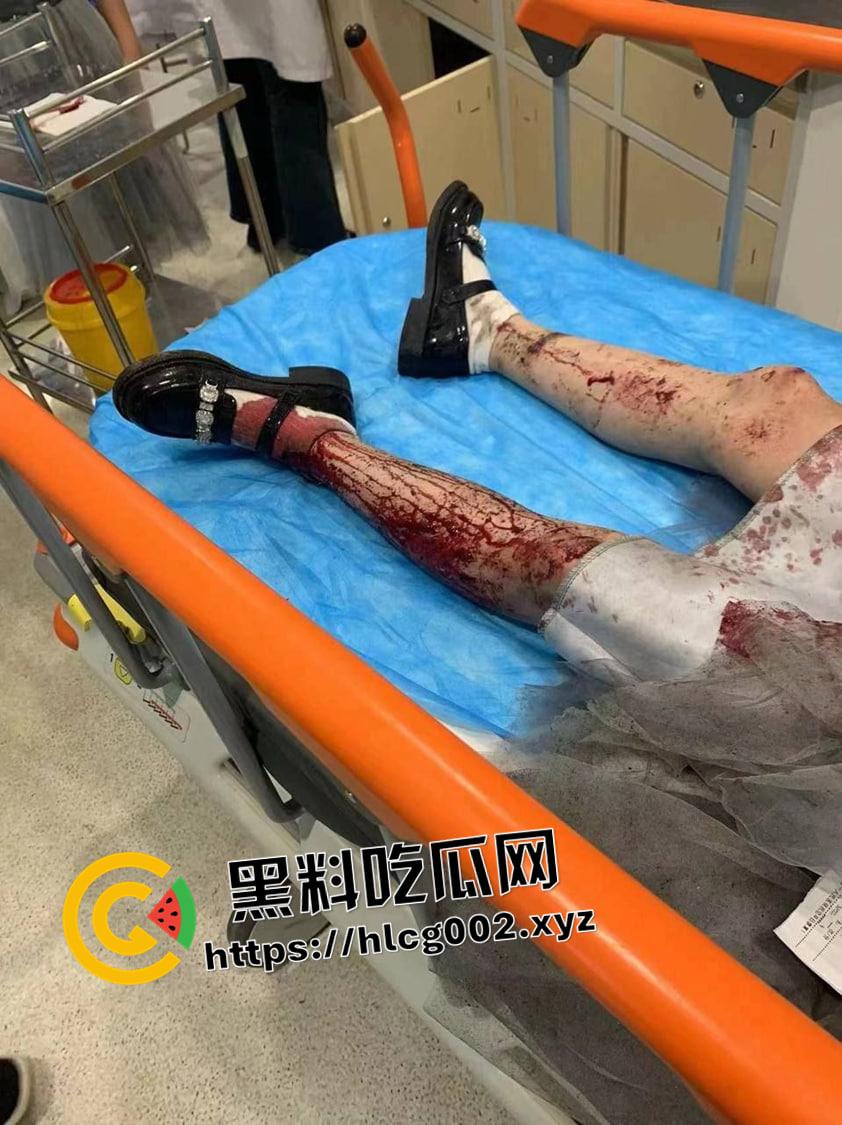 江苏南通渣土车撞翻装满春游学生的校车  死伤无数 一地尸体碎片 现场血腥视频流出-3