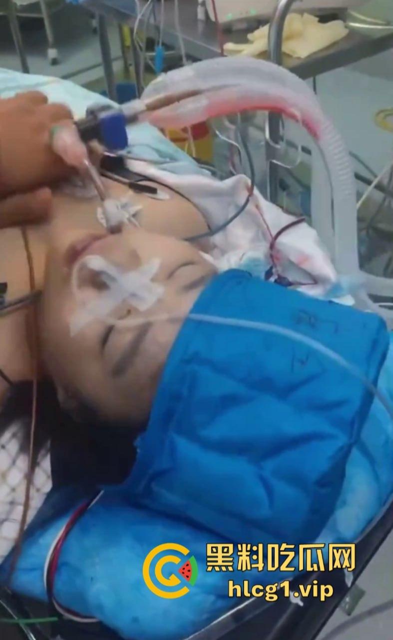 活阎王!哈尔滨市10岁小女孩微创手术身亡 器官被单独摘走!-7