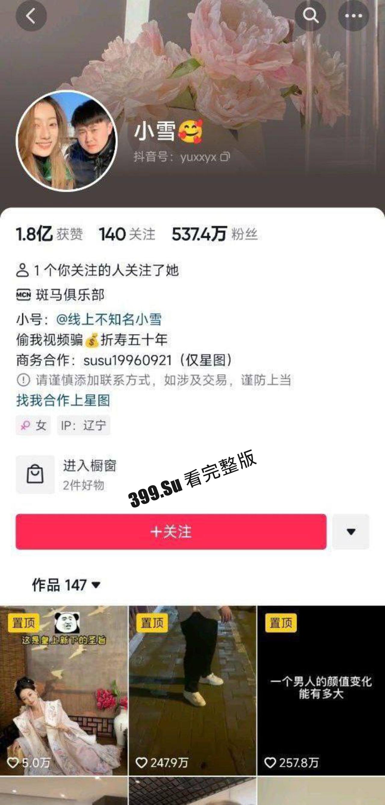 抖音500万粉博主 小雪（两千万粉 张百乔 媳妇）  裸照曝光 身材真不错 雀黑-1