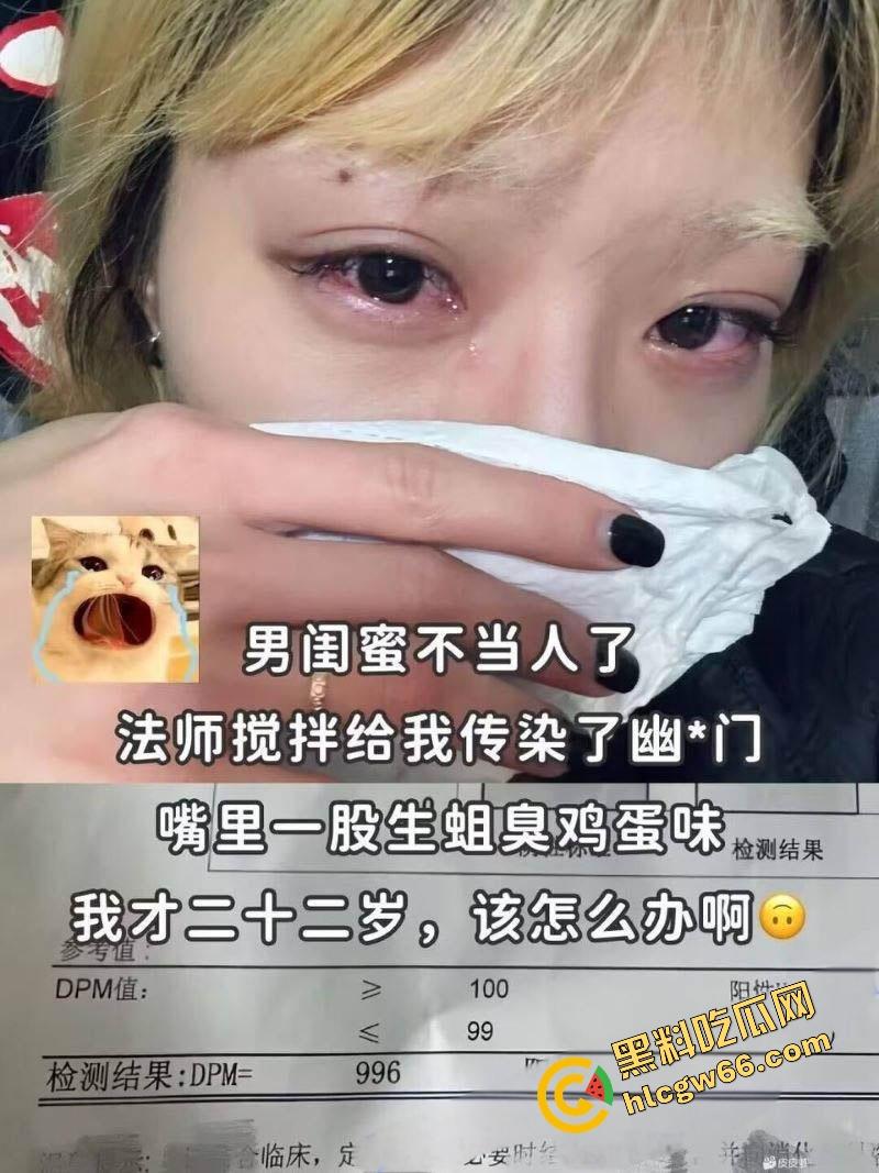 22岁美女被男闺蜜干爆肛后立马口交吃自己屎，惨遭幽门螺杆菌入侵，嘴里臭过粪坑，这操作太逆天！-1