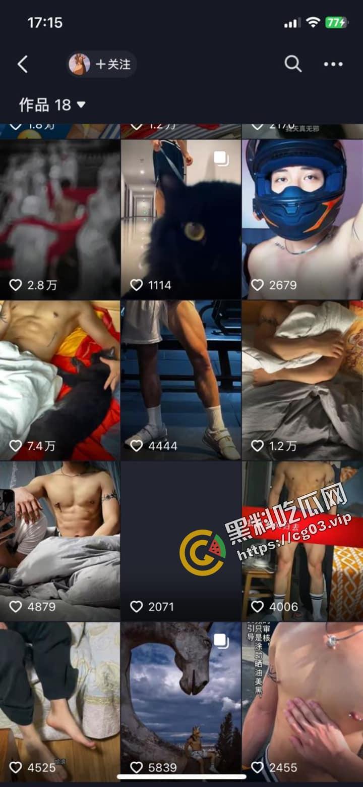 抖音【小汪肌】（车祸卧床版）同性恋体育生 真的死了都要作秀-2