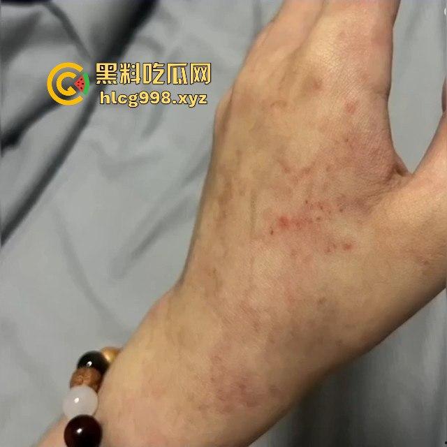 杭州惊现强吻狂魔！夜晚女生嘴唇被咬破，路人看了都以为是情侣打情骂俏，结果真是猥亵！-12