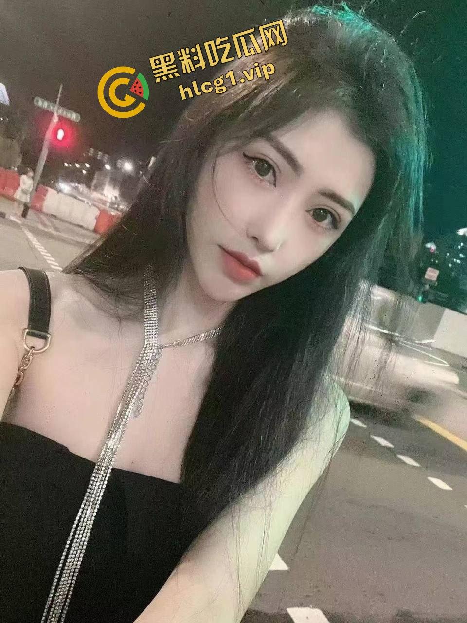 每个人体质不一样！瘦脸医美针害死人！肉毒整容 那女的 变 那女神！-11