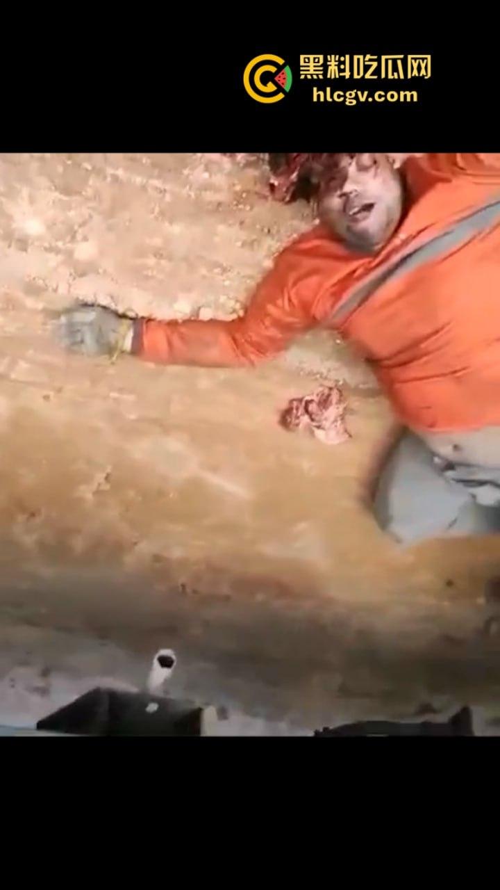 太惨了！因操作不当 巴西倒霉男子脑袋被挤爆  血腥现场视频曝光 胆小慎入-8