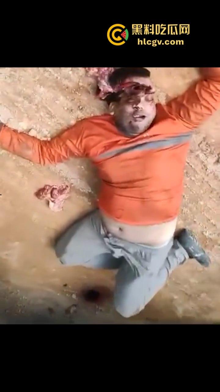 太惨了！因操作不当 巴西倒霉男子脑袋被挤爆  血腥现场视频曝光 胆小慎入-9