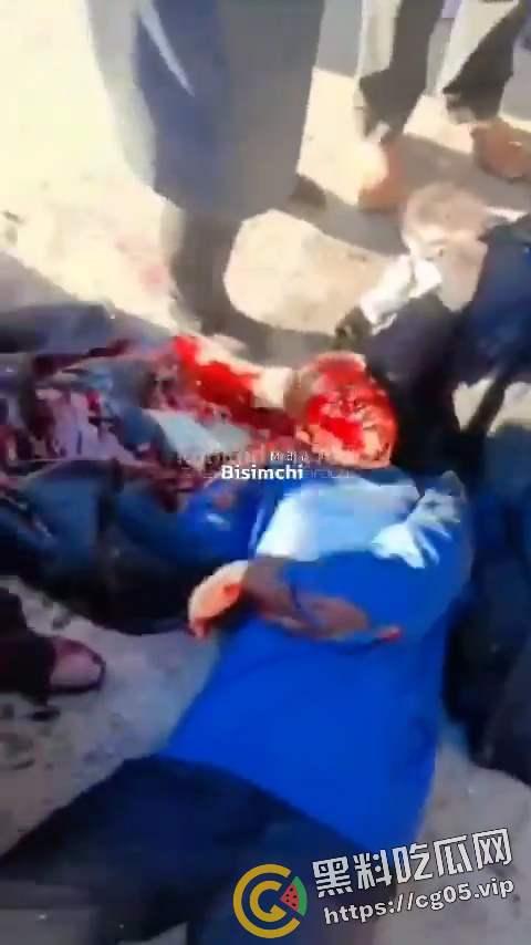 伊朗纪念已故将军卡西姆·苏莱马尼举办纪念仪式 现场发生两起爆炸 死伤数百人 惨不忍睹-6