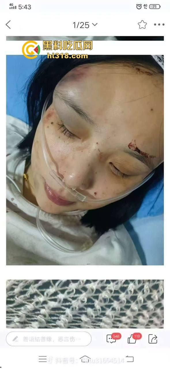 四川江油霸凌事件!持着母亲是公安局副局长就随便霸凌残疾人的孩子?还诱导其父签谅解书,激起民愤!-13